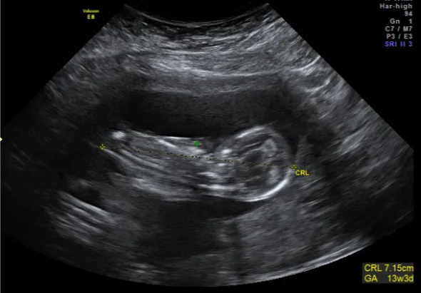 13 weeks