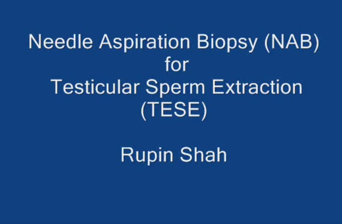TESE NAB Procedure | Sperm Retrieval | Dr. Rupin Shah