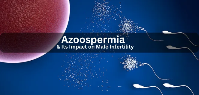 Azoospermia & Its Impact on Male Infertility